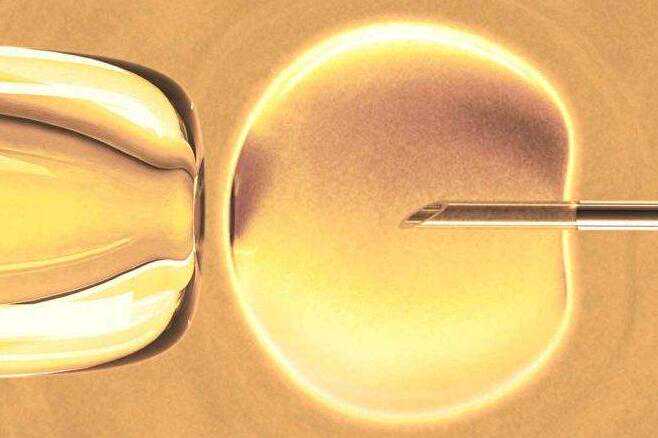 做试管婴儿，光准备钱就够了吗？还有7个小细节要注意