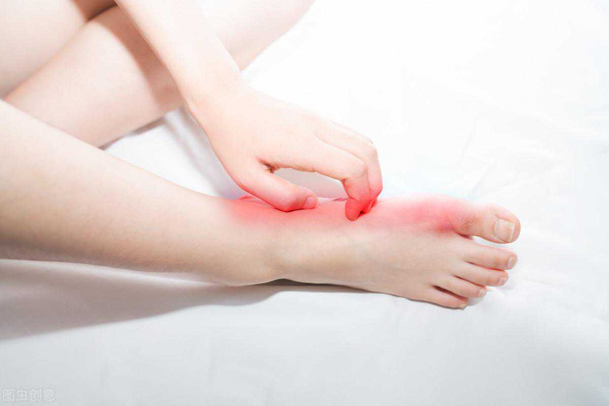 孕期脚气又痒又痛让人坐立难安，如何做好治疗？